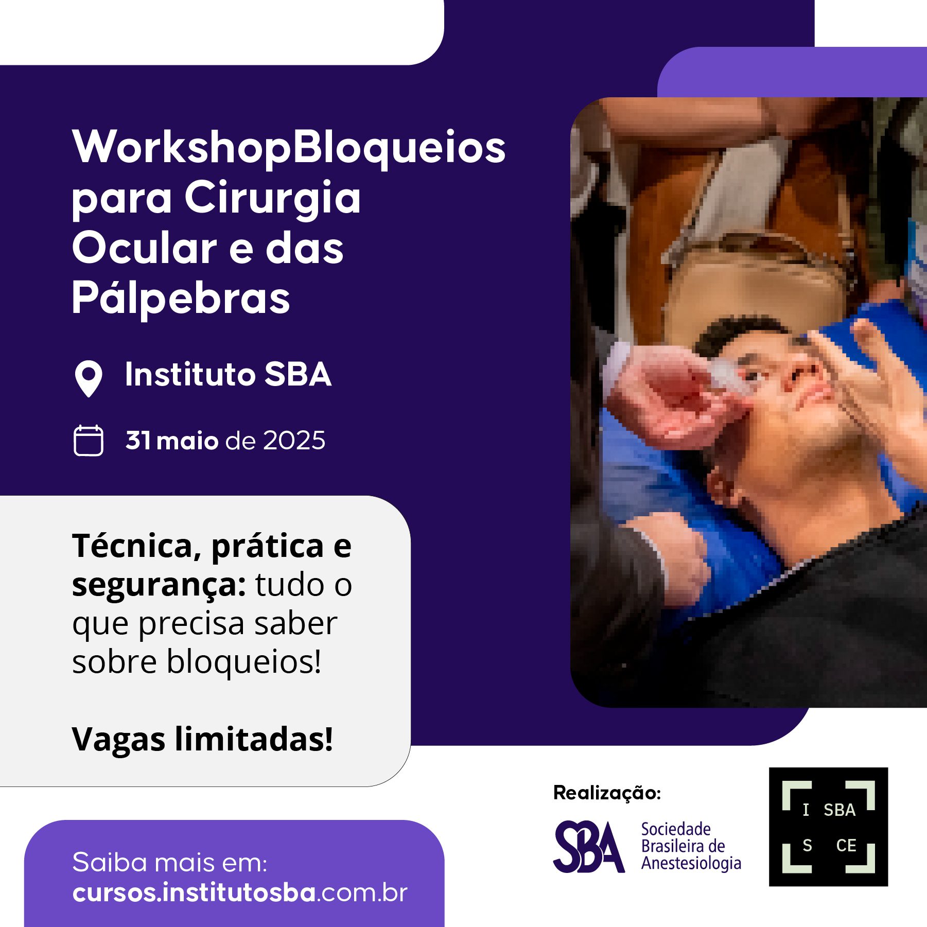 Workshop Bloqueios para Cirurgia Ocular e das Pálpebras