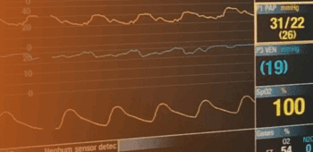 Monitorização Hemodinâmica
