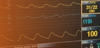 Monitorização Hemodinâmica Avançada no Perioperatório: Teoria, Prática e Simulação Realística